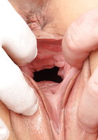 Гинеколог растягивает пальцами половые губы зрелой пациентки 6 фото Гинеколог растягивает пальцами половые губы зрелой пациентки 6 фото